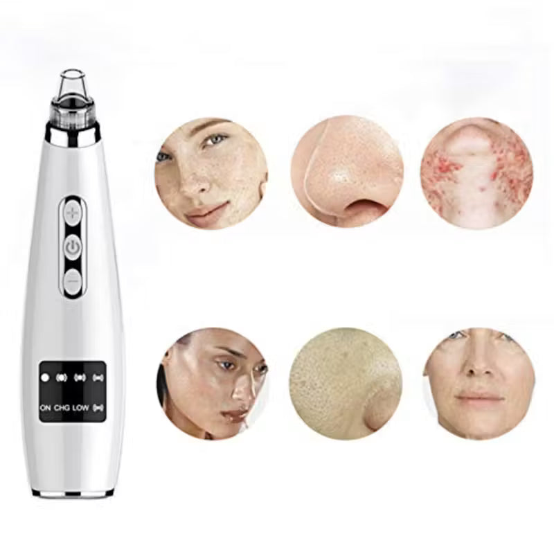 Electric Black Head Suction Instrument Face Cleaner
