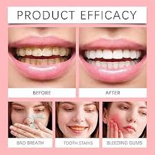 SP-8 Probiotic Dental Care Toothpaste