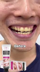 Dr Rashel - Whitening Tooth Paste